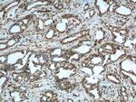 FUS/TLS Antibody in Immunohistochemistry (Paraffin) (IHC (P))