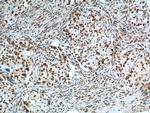 FUS/TLS Antibody in Immunohistochemistry (Paraffin) (IHC (P))