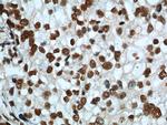 FUS/TLS Antibody in Immunohistochemistry (Paraffin) (IHC (P))