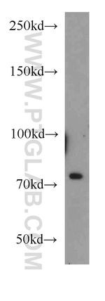 FUS/TLS Antibody in Western Blot (WB)