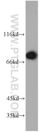 FUS/TLS Antibody in Western Blot (WB)