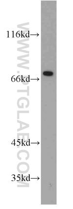 FUS/TLS Antibody in Western Blot (WB)