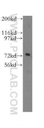 FUS/TLS Antibody in Western Blot (WB)