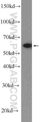 FUS/TLS Antibody in Western Blot (WB)