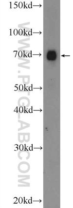 FUS/TLS Antibody in Western Blot (WB)