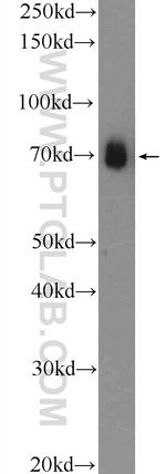 FUS/TLS Antibody in Western Blot (WB)