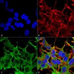 SUR2A Antibody in Immunocytochemistry (ICC/IF)