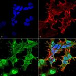 TARP2/4/8/Stargazin Antibody in Immunocytochemistry (ICC/IF)