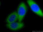 PSMA6 Antibody in Immunocytochemistry (ICC/IF)