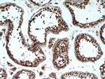 PSMA6 Antibody in Immunohistochemistry (Paraffin) (IHC (P))