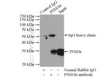 PSMA6 Antibody in Immunoprecipitation (IP)