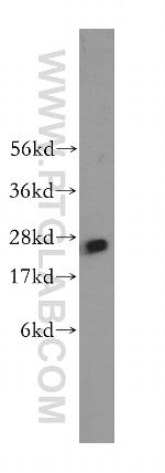 PSMA6 Antibody in Western Blot (WB)