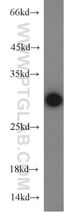 PSMA6 Antibody in Western Blot (WB)