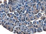 OGT Antibody in Immunohistochemistry (Paraffin) (IHC (P))