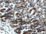 OGT Antibody in Immunohistochemistry (Paraffin) (IHC (P))