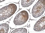 OGT Antibody in Immunohistochemistry (Paraffin) (IHC (P))