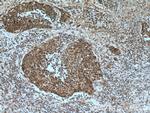 OGT Antibody in Immunohistochemistry (Paraffin) (IHC (P))