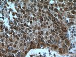 OGT Antibody in Immunohistochemistry (Paraffin) (IHC (P))