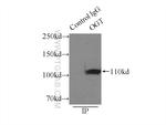 OGT Antibody in Immunoprecipitation (IP)