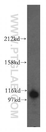 OGT Antibody in Western Blot (WB)