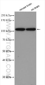 OGT Antibody in Western Blot (WB)