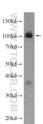 OGT Antibody in Western Blot (WB)