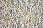 LIAS Antibody in Immunohistochemistry (Paraffin) (IHC (P))