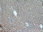 LIAS Antibody in Immunohistochemistry (Paraffin) (IHC (P))