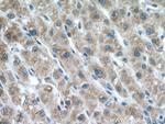 LIAS Antibody in Immunohistochemistry (Paraffin) (IHC (P))