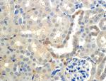 ENaC beta Antibody in Immunohistochemistry (IHC)