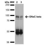 ENaC beta Antibody in Western Blot (WB)