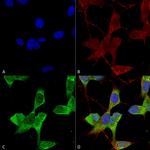 TASK1 Potassium Channel Antibody in Immunocytochemistry (ICC/IF)