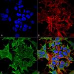 TASK1 Potassium Channel Antibody in Immunocytochemistry (ICC/IF)