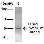 TASK1 Potassium Channel Antibody in Western Blot (WB)