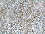 TNS4 Antibody in Immunohistochemistry (Paraffin) (IHC (P))