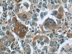 TNS4 Antibody in Immunohistochemistry (Paraffin) (IHC (P))