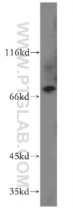 TNS4 Antibody in Western Blot (WB)