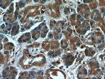 MTRF1 Antibody in Immunohistochemistry (Paraffin) (IHC (P))