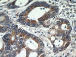 GRP78/BIP Antibody in Immunohistochemistry (Paraffin) (IHC (P))