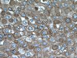 GRP78/BIP Antibody in Immunohistochemistry (Paraffin) (IHC (P))