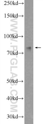 GRP78/BIP Antibody in Western Blot (WB)