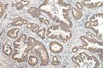 GRP78/BIP Antibody in Immunohistochemistry (Paraffin) (IHC (P))