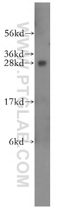 RABL2B Antibody in Western Blot (WB)