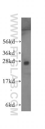 RABL2B Antibody in Western Blot (WB)