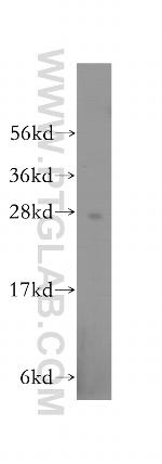 RABL2B Antibody in Western Blot (WB)