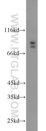 BRSK2 Antibody in Western Blot (WB)