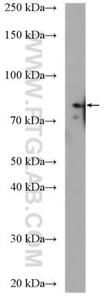 BRSK2 Antibody in Western Blot (WB)