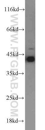 RGS5 Antibody in Western Blot (WB)