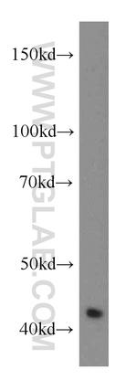 RGS5 Antibody in Western Blot (WB)