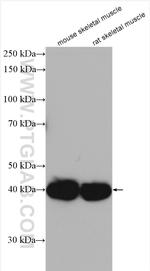 RGS5 Antibody in Western Blot (WB)